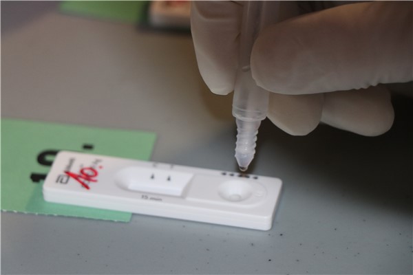 Zpracování antigenního test na vir SARS CoV-2. Foto: KZ  a. s./Petr Sochůrek